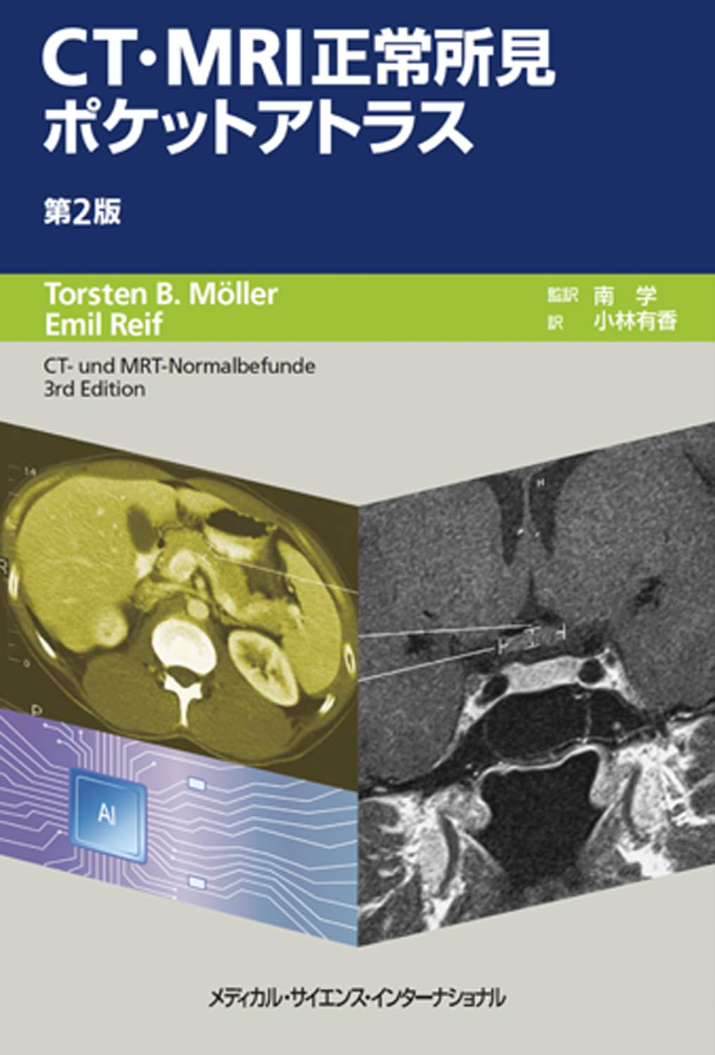 CT・MRI正常所見ポケットアトラス 第2版 | 南 学, 小林有香 |本 | 通販